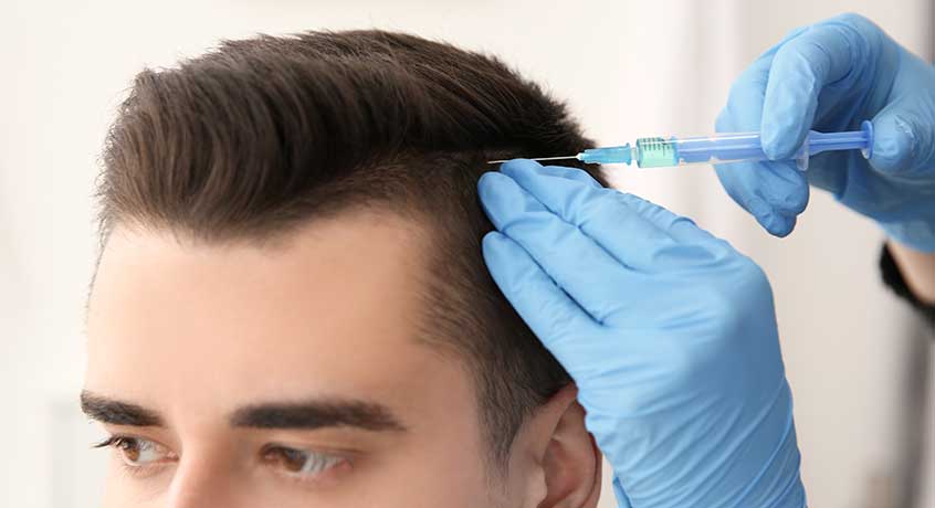 PRP Saç Tedavisi